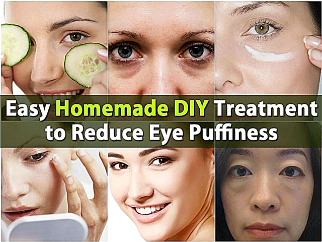 Лесно домашно домашно лечение за намаляване на подпухналостта на очите